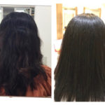 酸熱トリートメント