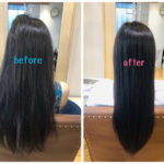 ~プレックスメント トリートメント~