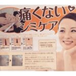 ダウンタイムがない！痛くないシミケア！