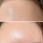 アズイリスを２日間塗った結果。。。